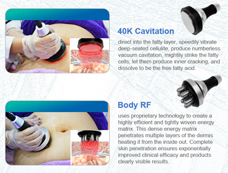 4 groups cycle modes for  operation, parameters can be set flexibly; 8 pcs different sizes cryo handles  are suitable for different size areas and body shape