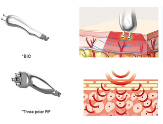 Heats skin tissue to absorb large amounts of heat and then smoothes it with newcollagen Wrinkles, tighten skin, delay skin aging, dilute fine lines, remove dark circles
The use of dermal collagen celluloseimmediately produces a contraction principle at 45-60C' which can smooth wrinkles.tighten the skin and delay skin aging.