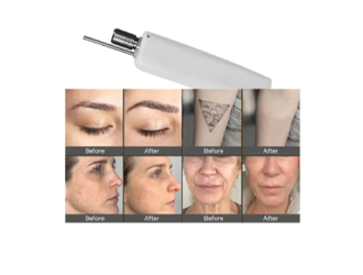 Pico laser : Remove melasma, freckles, agespots, brown nevus, acne and otheendogenous pigments,.Wash eyebrows, tattoos, molesbirthmarks, remove nevus of Ota,