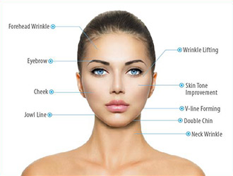 Whole facial forehead, eyes, mouth, neck etc. wrinkles removal, facial skin lifting and tightening.